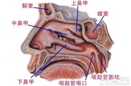 鼻窦炎能彻底治好吗 鼻炎鼻窦炎根治方法