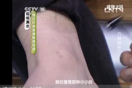 健康之路程凯 健康之路20130706视频程凯：穴到病除（2）——肾虚【文字 视频】