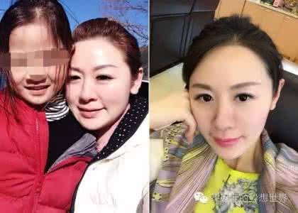 脸太胖怎么瘦下来 脸太胖怎么瘦下来 胖的人各有各的借口，瘦下来只有一个理由