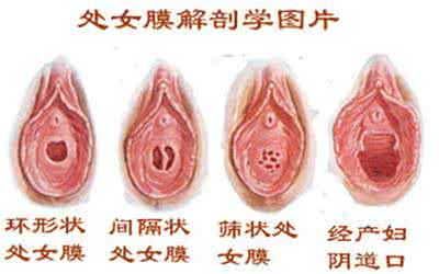 炎不破摸末炎的内裤 处女摸没破会怀孕么？