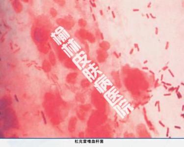 我的阴唇怎么变回粉色 乳房乳晕和阴唇怎么变粉色