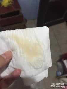 羊水浑浊能顺产吗 孕晚期羊水浑浊