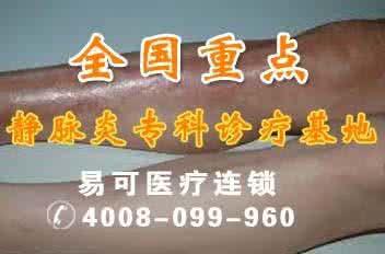 血栓性浅静脉炎 祖传秘方：血栓性浅静脉炎百治百愈神妙汤