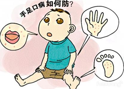 手足口病患儿的饮食 手足口病高发期 手足口病高发期重症患儿病情进展快 家长应警惕