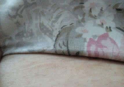 医生为什么会建议竖切 剖腹产横切和竖切的区别