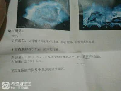 月经推迟两个月的原因 月经推迟十四天 月经推迟十四天是什么原因