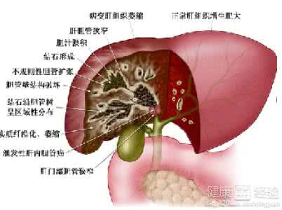 胆囊炎病因 找到一个对治胆病(如胆囊炎、嘴苦)的有效点