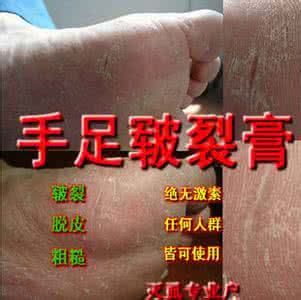 明矾溶液 图文:手足皲裂疗效百分百明矾马及液