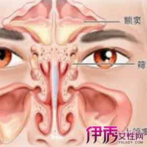鼻窦炎穿刺手术图解 图解:鼻窦炎