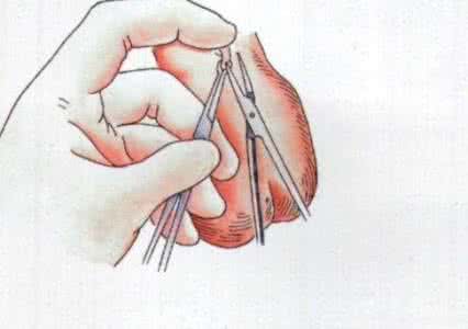 射精量少怎么回事 性生活时男性射精量少要怎么补