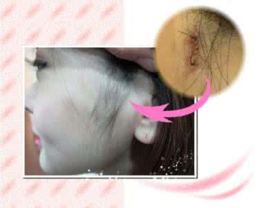 脆骨 成分 29岁女子竟成“骨脆脆” 咖啡不离手水果当饭吃