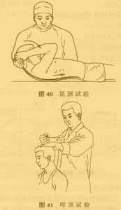 体格试验检查 推拿学试验检查