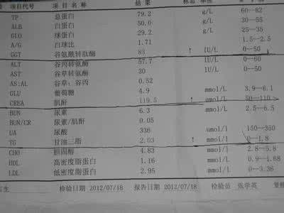 肌酐偏高的原因 肌酐高 肌酐高的原因，肌酐高怎么办