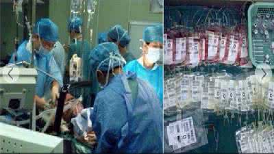 羊水栓塞 医学院女教师羊水栓塞 全身换血8遍仍危急