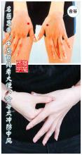 合谷太冲 名医忠告：中风前兆看大便，合谷太冲防中风