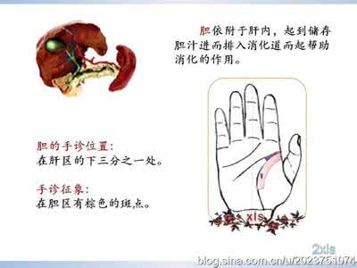 慢性胆囊炎 手诊保健知识——12、慢性胆囊炎*