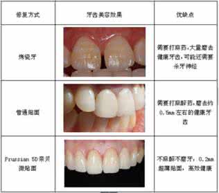 烤瓷牙有没有什么危害 烤瓷牙的危害有什么