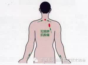 浮针 【特色医疗】浮针连载14：异常情况的处理和预防及注意事项