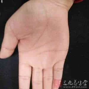 手掌的正常颜色高清图 手掌变成这样颜色竟是血癌早期