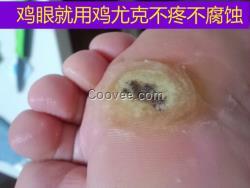 脚底发黄是什么原因 脚底发黄是什么原因 诱发因素告诉你