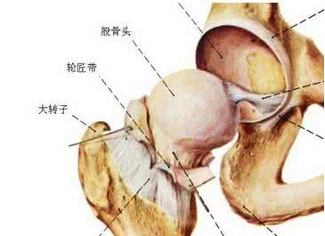 针灸治疗股骨头坏死 针灸治疗股骨头坏死有奇效:论文
