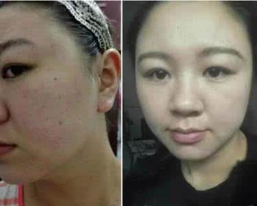 大姜斑点病 20岁妙龄女一夜变80岁 姜遇上它,一夜斑点不见了,40岁年轻如20岁少女