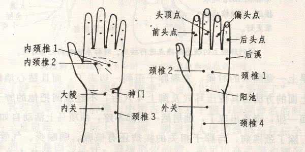 祖传的颈椎病特效秘方 周尔晋先生治颈椎病的手穴秘方