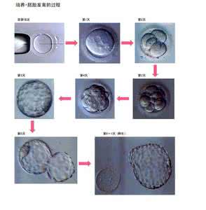 试管婴儿胚胎级别 试管婴儿胚胎级别 试管婴儿胚胎级别划分