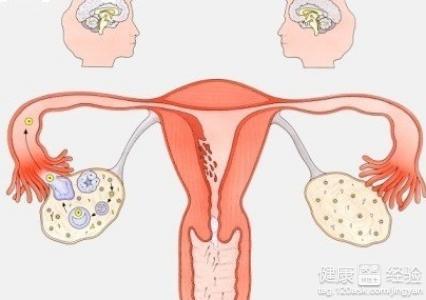 怎么样护理卵巢 卵巢术后护理怎么做呢？