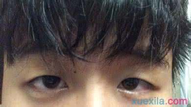 黑眼圈的形成原因 黑眼圈是怎么形成的?黑眼圈的原因