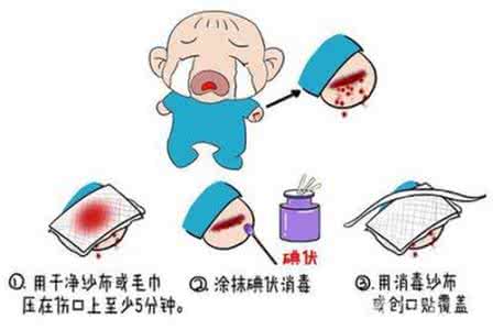 院前急救指南 院前急救指南 这份美国儿童急救指南,每个父母都要收藏,关键时能救命的??