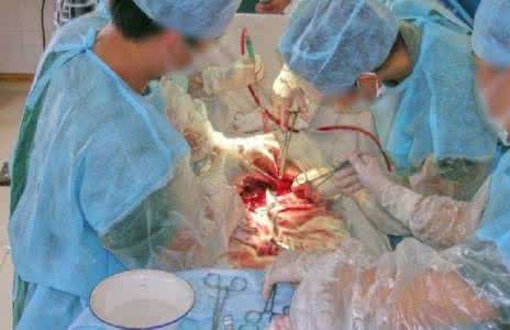 剖腹产会有什么后遗症 什么情况下需要剖腹产