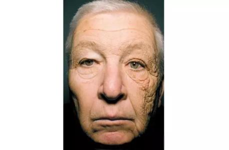 漫威里的黑光杀手 “光老化”现今成为颜值第一杀手