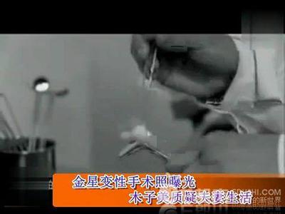 男人为什么做变性手术 金星为什么要做变性手术