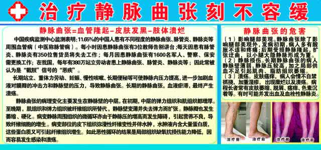 舒静通修静脉曲张可行 糖尿病人静脉曲张 糖尿病人这样吃,送你一张对照表