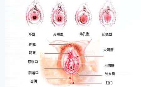 外阴白斑有什么症状 外阴白斑 外阴白斑有什么症状