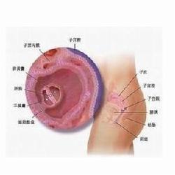 子宫内膜炎吃什么药 急性子宫内膜炎吃什么药好？3款中药方药效好