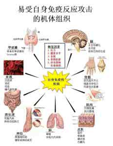 自身免疫性疾病的自愈 自身免疫性疾病