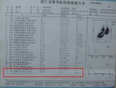 c反应蛋白高正常值 c反应蛋白高是怎么回事 c反应蛋白高正常值