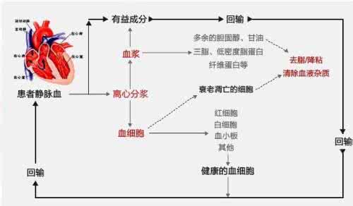自体输血 自体输血为分娩加道“安全锁”