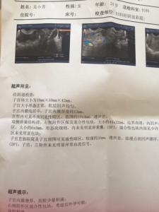 初期宫外孕治疗方法 宫外孕初期的处理方法 宫外孕的处理方法