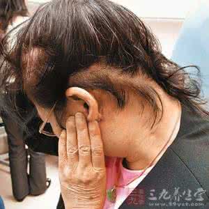 腮腺肿瘤 医生称脸部腮腺肿瘤多为良性 久拖可产生恶变