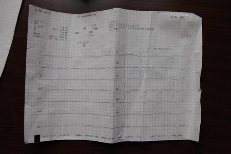 天下奇方治百病神效方 神效奇方--治心律不齐方