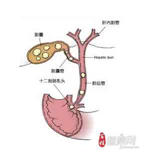 白点的发病原因有哪些 胆囊结石 它有哪些发病原因