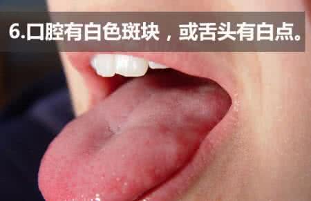 癌症的早期症状 癌症的14大症状