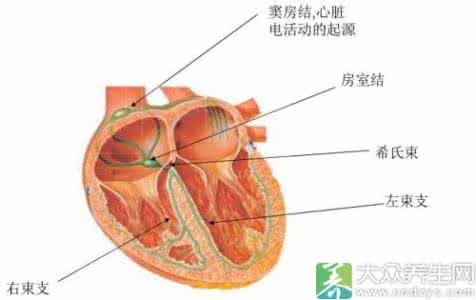 安装起搏器后注意事项 安装起搏器后注意事项 安装起搏器之后要注意什么