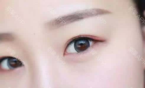 做完美瞳线几天消肿 纹美瞳线如何快速消肿 做完美瞳线后怎么快速消肿？