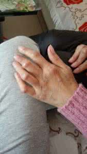 类风湿性关节炎治疗法 类风湿性关节炎的中药疗法有哪些