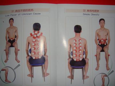 旅游英语图解一看就会 拔罐图解 一看就会