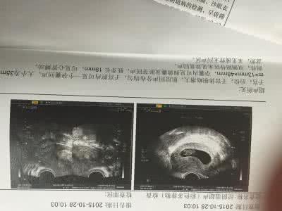 怀孕多久可以看出男女 孕酮能看出怀孕吗 孕酮可以看出怀孕吗